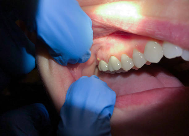 Best Broken Tooth Emergency  in Sharon, TN